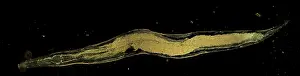 Worms: Dark Field Light Micrograph (LM): Human Pinworm