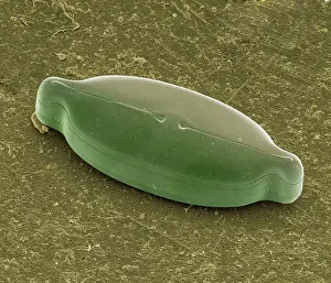 Microscope: Diatom