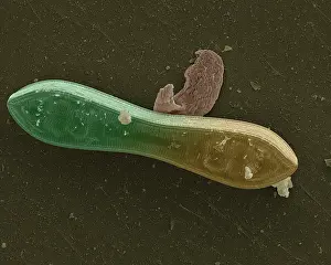 Microscope: Diatom
