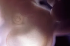 Micro: Eye detail of a rat embryo at 13.2 days after fertilisation