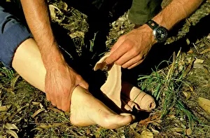Bandage: First aid for snake bite: constrictive bandage