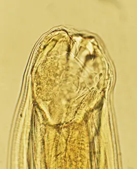 Micrographs: Hookworm