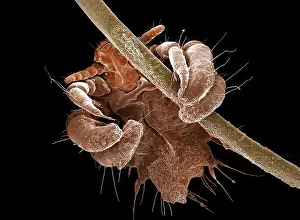 Lice: Human Crab Louse