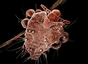 Lice: Human Crab Louse