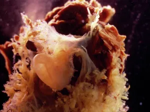Lifecycle: Human Embryo With Placenta