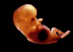 Fertilisation: Human Foetus 10-11 weeks after fertilisation