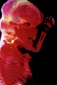 Twelve: Human Foetus 12 weeks - red dye to show bones