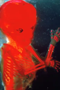 Micro: Human Foetus 12 weeks - red dye to show bones