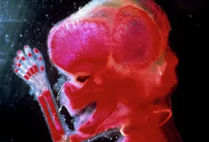 Lifecycle: Human Foetus - red dye to show bones