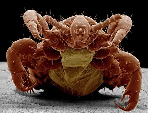 Lice: Human Head Louse