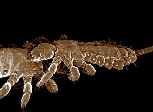 Lice: Human Head Louse
