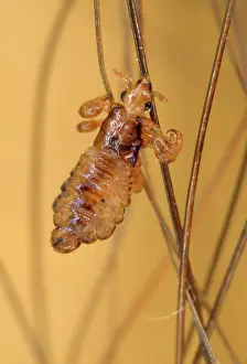 Lice: Human Head Louse - on hair