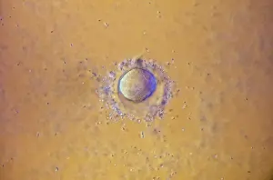 Sperm: A human Ovum surrounded by Sperm - being fertilized