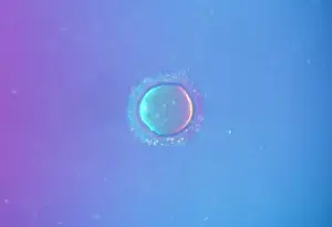 Sperm: A human Ovum surrounded by Sperm - being fertilized
