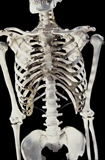 Scan: Human Skeleton