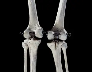 Scan: Human Skeleton