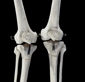 Scan: Human Skeleton