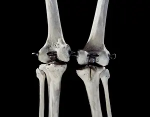 Knees: Human skeleton - body structure - upper body -
