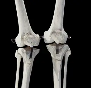Knees: Human skeleton - body structure - upper body -
