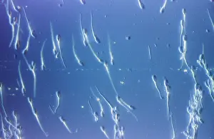 Sperm: Human Sperm