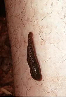 Biting: JUNGLE LEECH BITING HUMAN LEG