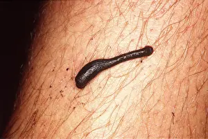 Worm: LEECH ON LEG - feeding from human host