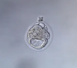 Microscope: Light Micrograph of Cavitated Mouse Blastocyst