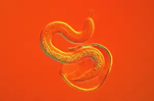 Light Micrograph. CHI0515