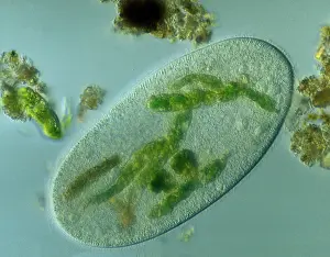 Planktons: Light Micrograph: Ciliate