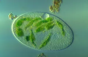 Planktons: Light Micrograph: Ciliate