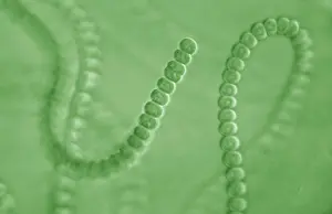 Micro: Light Micrograph: Cyanobacterium