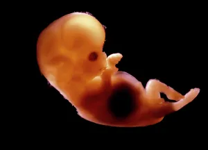 Fertilisation: Light Micrograph of Human Foetus 10-11 weeks after
