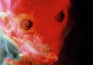 Foetus: Light Micrograph of Human Foetus 12 weeks - red