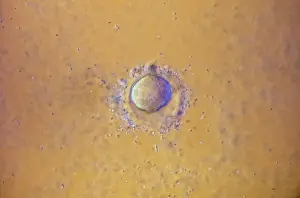 Sperm: Light Micrograph of human Ovum surrounded by Sperm