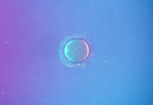 Sperm: Light Micrograph of human Ovum surrounded by Sperm