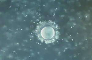 Sperm: Light Micrograph of human Ovum surrounded by Sperm