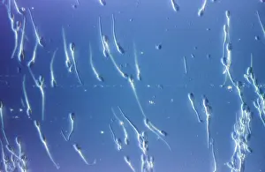 Sperm: Light Micrograph of Human Sperm;