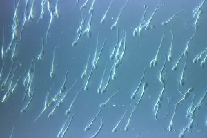 Sperm: Light Micrograph of Human Sperm