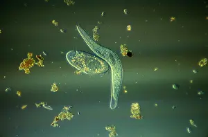 Planktons: Light Micrograph (LM): Elongate Ciliate and Paramecium