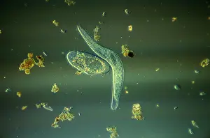 Micrographs: Light Micrograph (LM): Elongate Ciliate and Paramecium