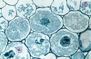 Cells: Light Micrograph (LM): Filaments of fungi Endotrophic
