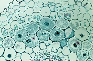 Cells: Light Micrograph (LM): Filaments of fungi Endotrophic