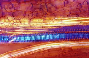 Thorns: Light Micrograph (LM): Longitudinal section of