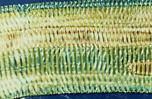 Vessels: Light Micrograph (LM): Longitudinal section shows