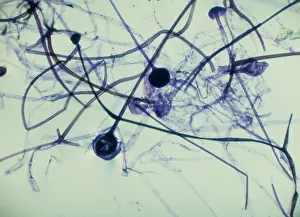 Bread: Light Micrograph (LM): Rhizopus sporangia