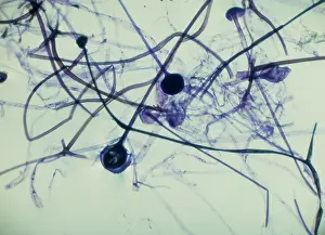Bread: Light Micrograph (LM): Rhizopus sporangia
