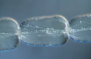 Stamens: Light Micrograph (LM): A single cell from a hair