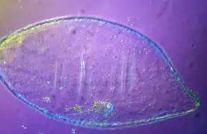 Magnification: Light Micrograph (LM): Tomato seed; Magnification