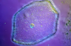 Magnification: Light Micrograph (LM): Tomato seed; Magnification