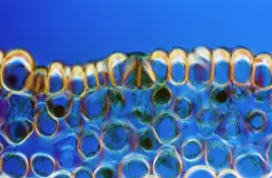 Transverse: Light Micrograph (LM): A transverse section of